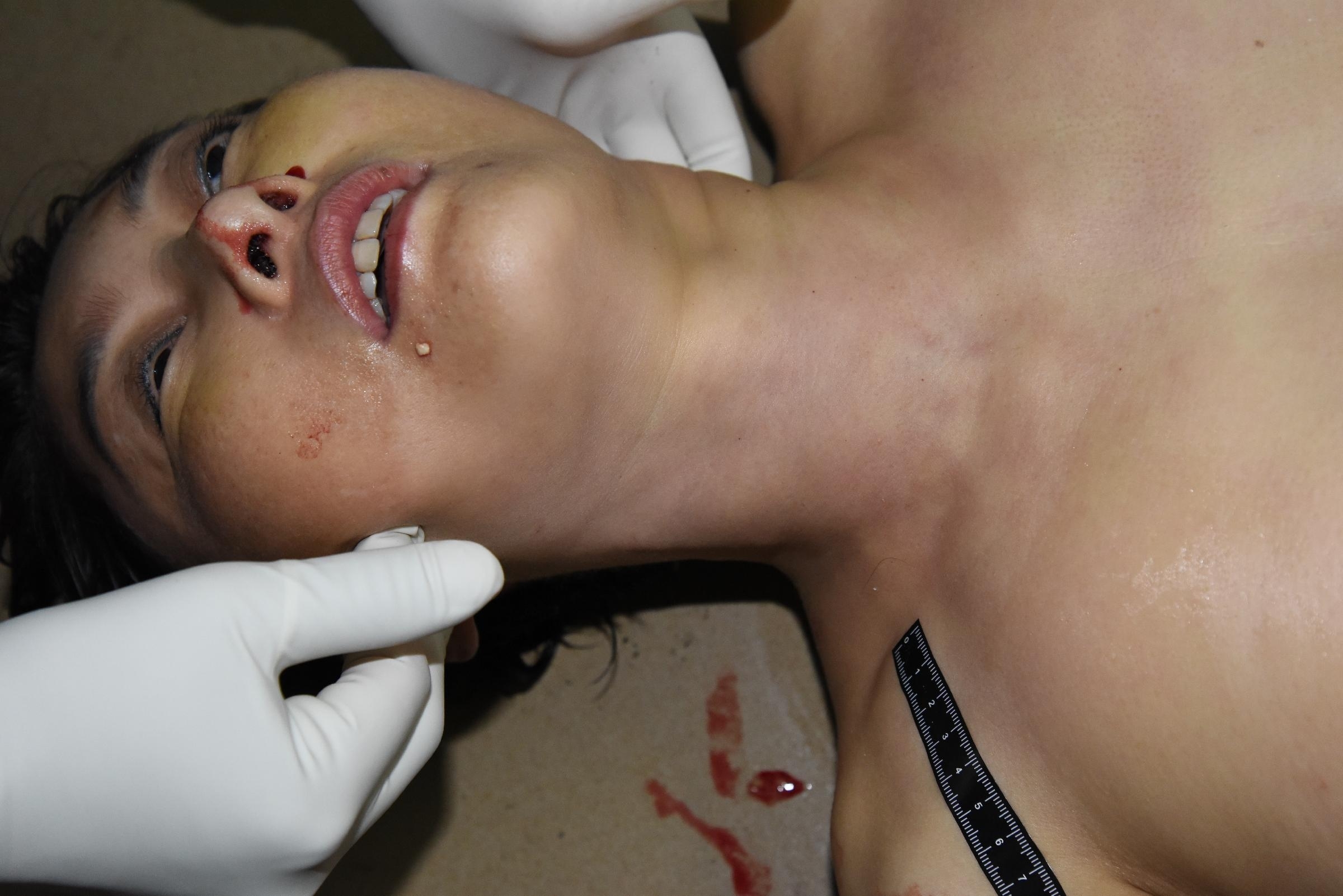 Female Found Naked on the Floor (examined) 