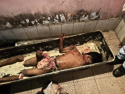 Man found dismembered in garbage bags in Manaus