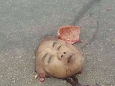 Man died in horrific accident his face removed from his place 
