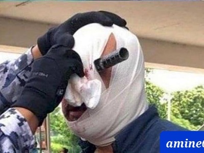 Jordanian military officer accidentally had a knife stuck in his eye